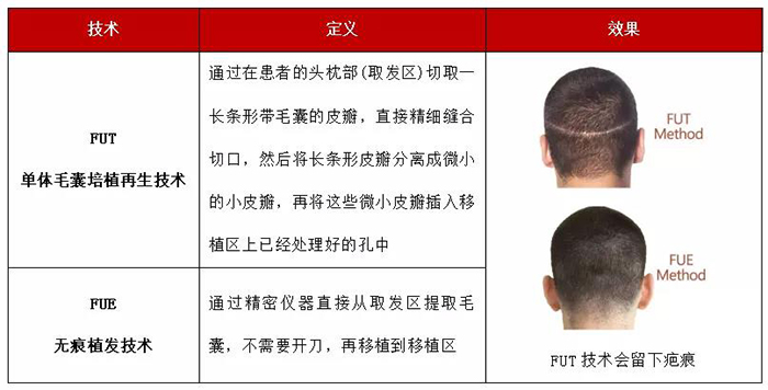 植发机器人1.jpg